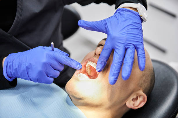 Best Emergency Broken Tooth Repair in Jefferson, TX